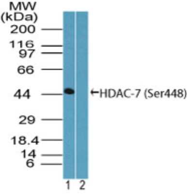 Western Blot: HDAC7 [p Ser448] Antibody [NBP2-03979]